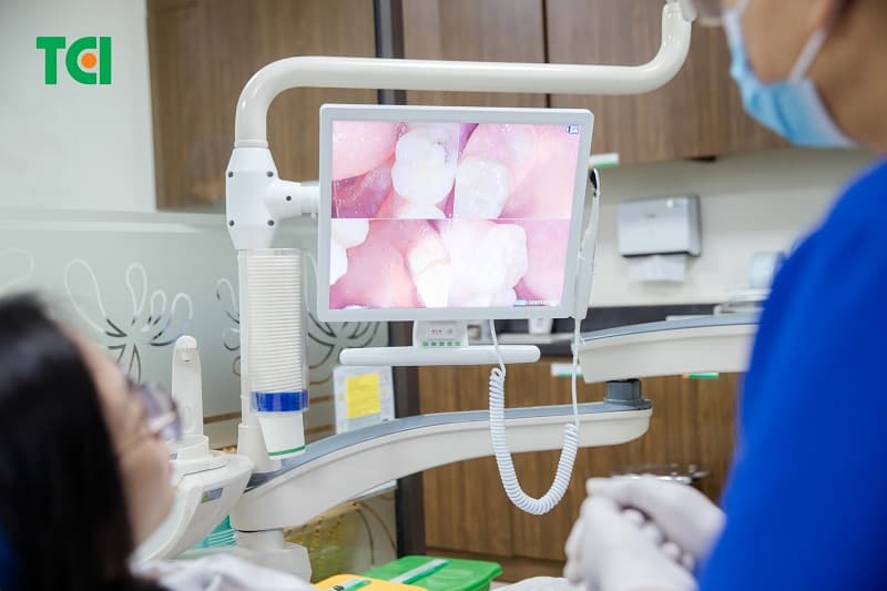 Thu Cúc TCI - địa chỉ khám răng uy tín Hà Nội