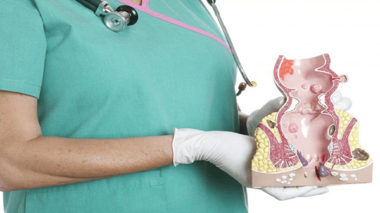 cân nhắc 5 yếu tố khi lựa chọn khám trĩ ở bệnh viện nào