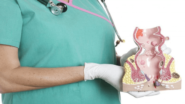 Cân nhắc 5 yếu tố khi lựa chọn khám trĩ ở bệnh viện nào