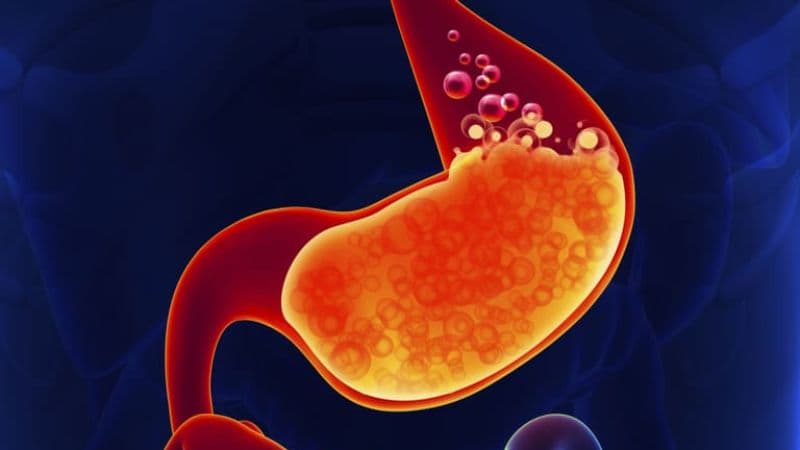 Nguyên nhân gây trào ngược axit 