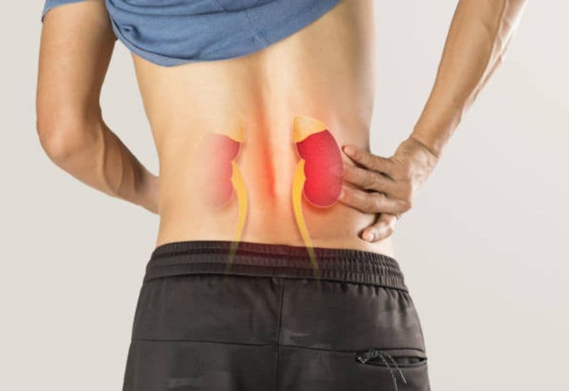 Giãn đài bể thận cấp độ 2 có phải là tình trạng nguy hiểm không?