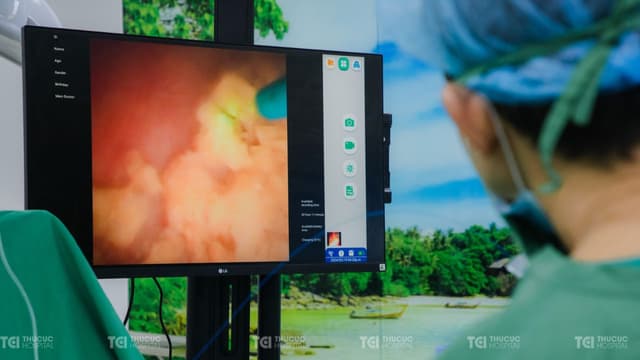 Tán sỏi niệu quản bằng laser là gì và mức độ hiệu quả