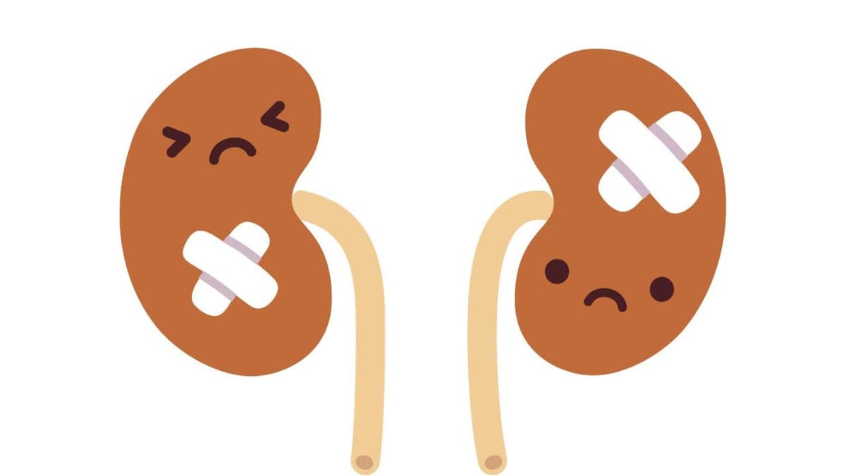 Thận ứ nước độ 2 là gì? Nguyên nhân và triệu chứng nhận biết