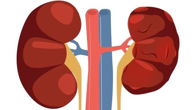 Thận ứ nước độ 4 là gì? Nguyên nhân và cách điều trị hiệu quả