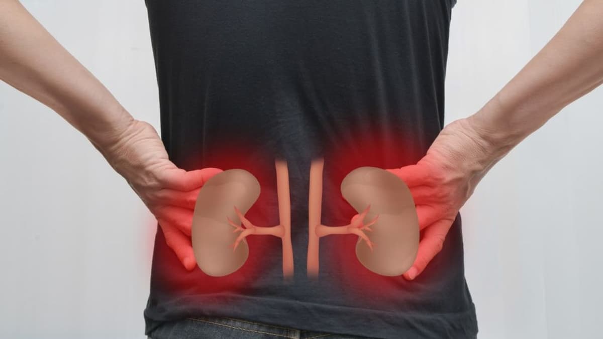 Thận ứ nước độ 1 và nguy cơ dẫn đến suy thận: Liên kết cần lưu ý