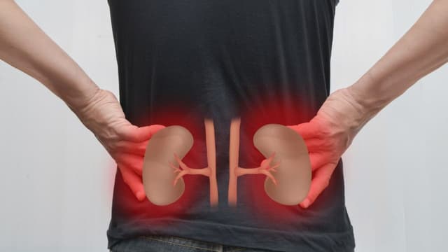 Thận ứ nước độ 1 và nguy cơ dẫn đến suy thận: Liên kết cần lưu ý