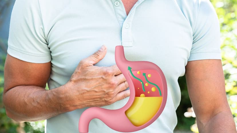 Trào ngược dạ dày ợ chua ở người trẻ: Vì sao ngày càng phổ biến