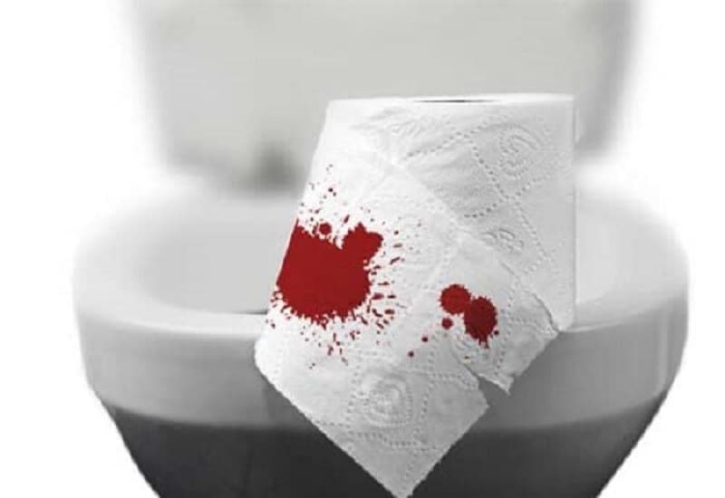 Trĩ nội đi ngoài ra máu