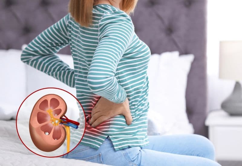 Triệu chứng xảy ra khi đài bể thận bị giãn