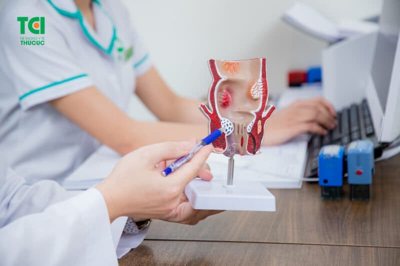 bệnh trĩ khi còn nhẹ thường được điều trị bằng phương pháp nội khoa