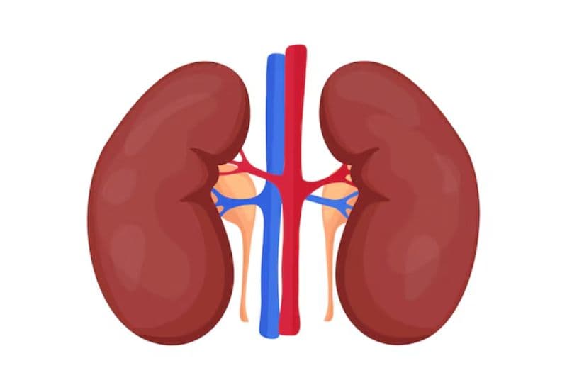 Thận ứ nước độ 3 là gì?