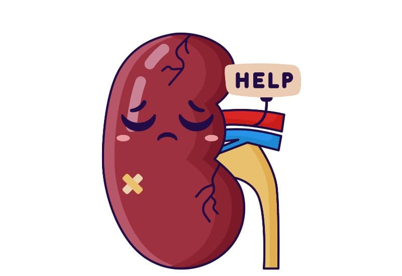 Thận ứ nước độ 4 là gì?