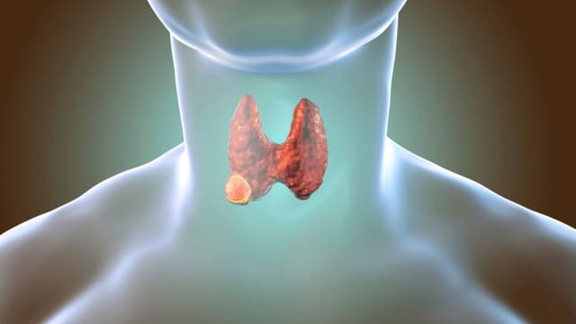 Đốt sóng cao tần u tuyến giáp 4cm được không?