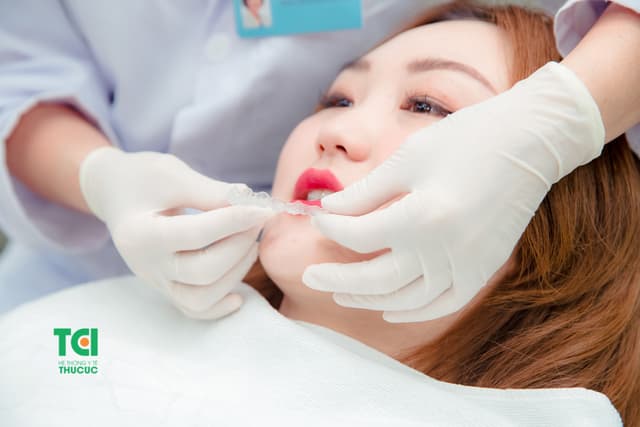 Niềng răng Invisalign