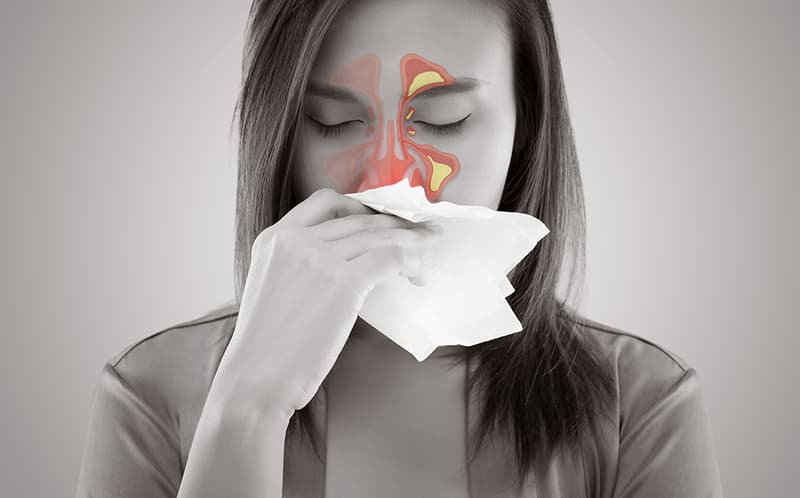 Bệnh viêm xoang mạn tính nguy hiểm không