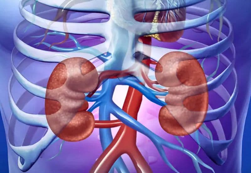 Những biến chứng khi giãn đài bể thận kích thước quá lớn