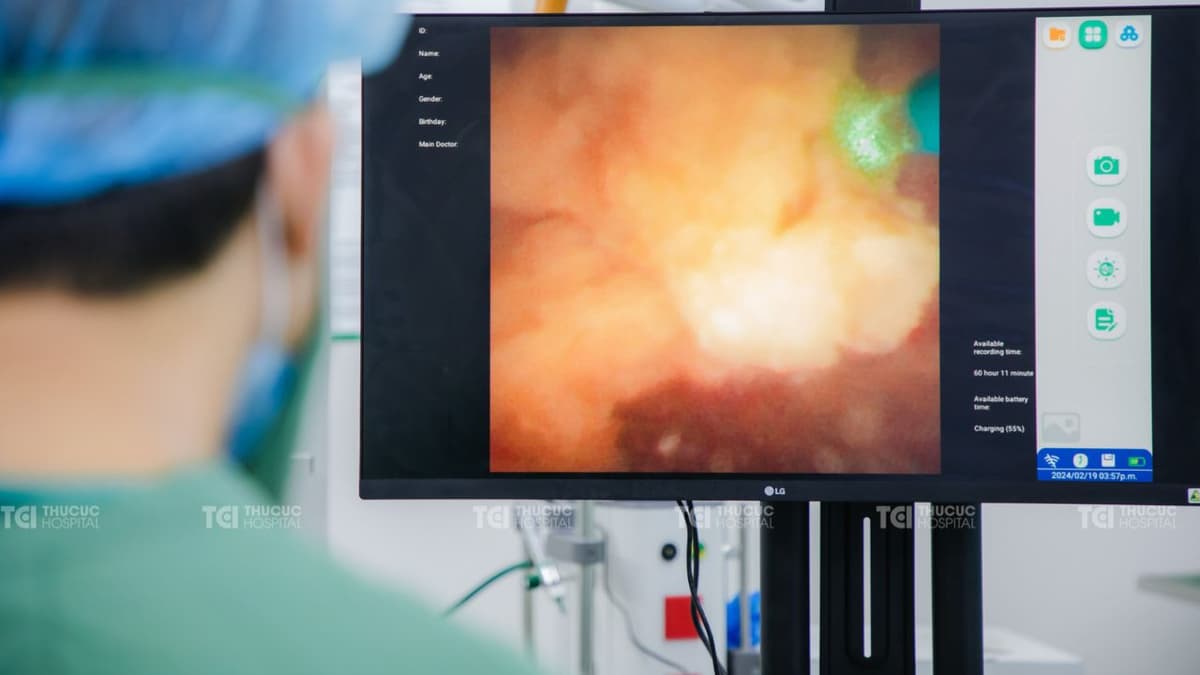 Cách điều trị bệnh sỏi tiết niệu bằng tán sỏi công nghệ cao