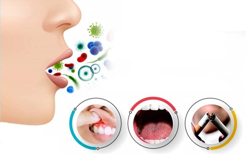 Bác sĩ chữa hôi miệng hiệu quả