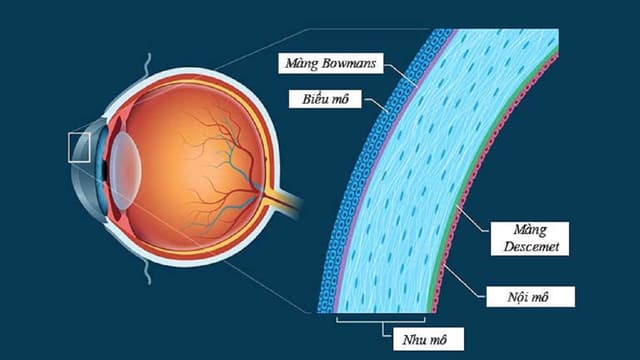 Chụp bản đồ giác mạc có vai trò như thế nào?