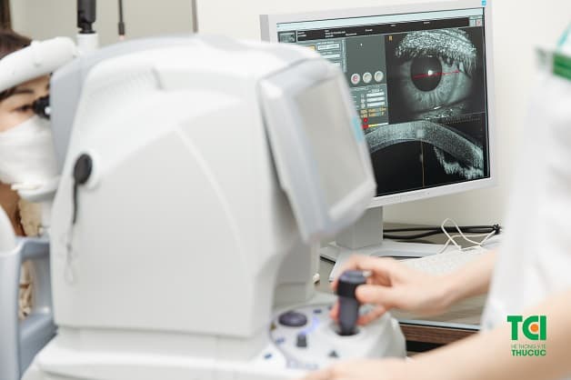 chụp cắt lớp võng mạc OCT