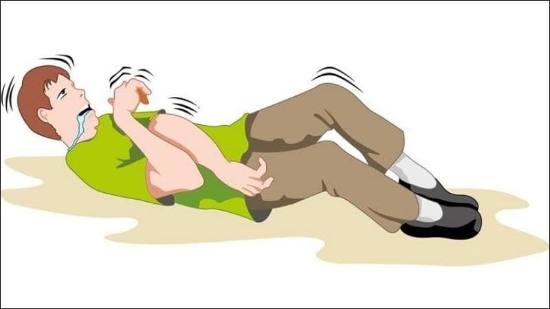 Co giật động kinh là gì?