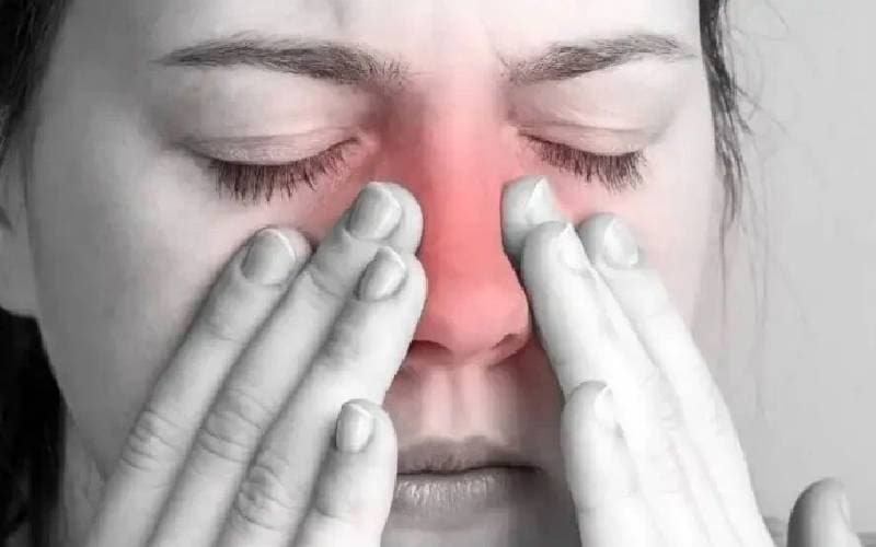 Cách Điều trị viêm xoang