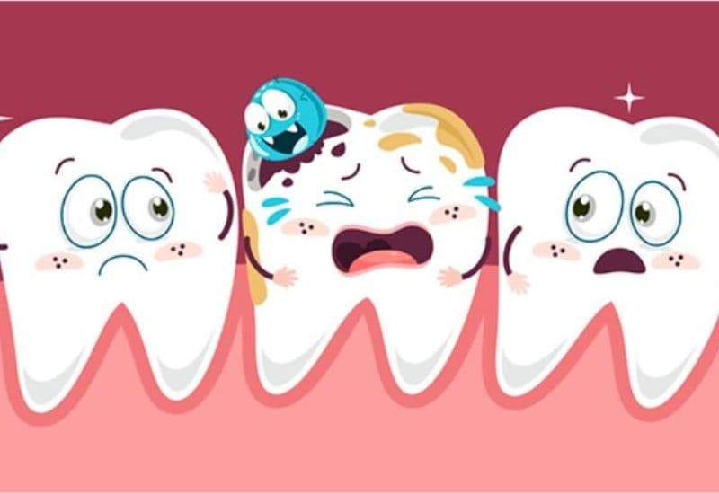 Sâu răng là nguyên nhân hàng đầu dẫn đến tình trạng bị hôi miệng.