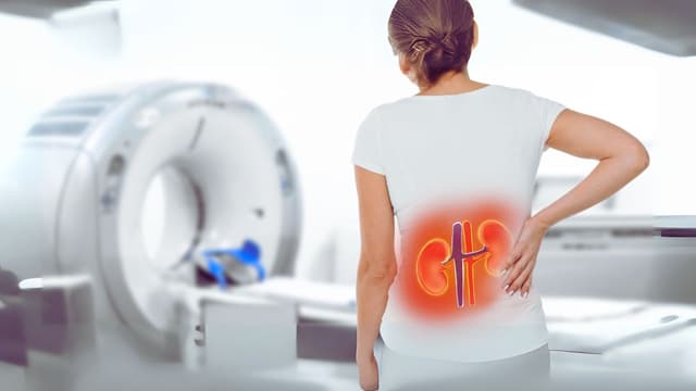 Khám giãn đài bể thận: Quy trình chẩn đoán chi tiết từ A-Z