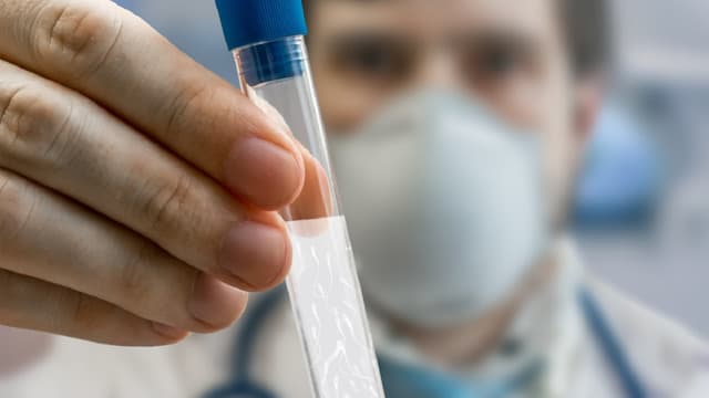 Tìm hiểu về phương pháp lọc rửa tinh trùng để thực hiện IUI