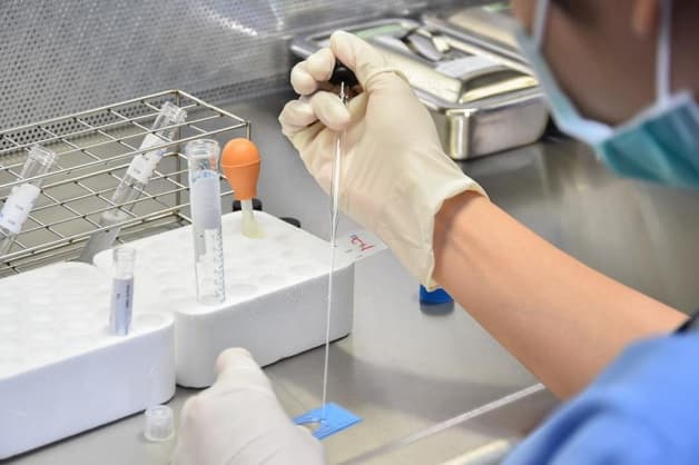 lọc rửa tinh trùng