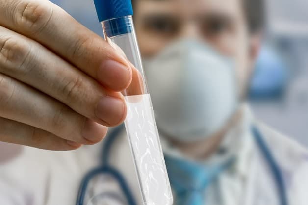 lọc rửa tinh trùng