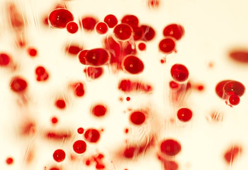 Nếu viêm phúc mạc không được điều trị kịp thời, vi khuẩn từ ổ nhiễm trùng có thể xâm nhập vào máu, gây nhiễm trùng huyết.