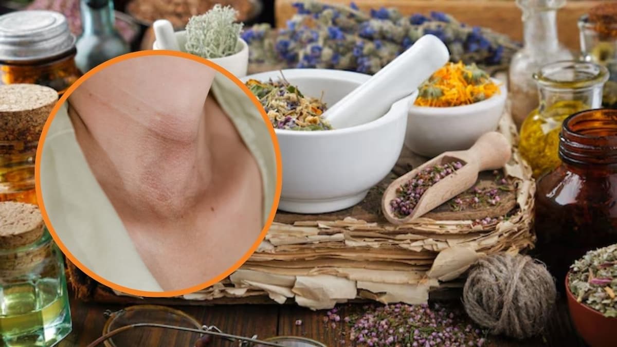 Cẩn trọng “tiền mất tật mang” với những mẹo chữa u tuyến giáp