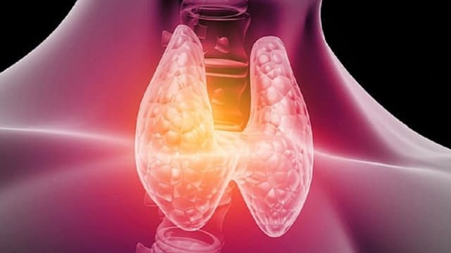 Biểu hiện của người bị bệnh cường giáp và cách điều trị