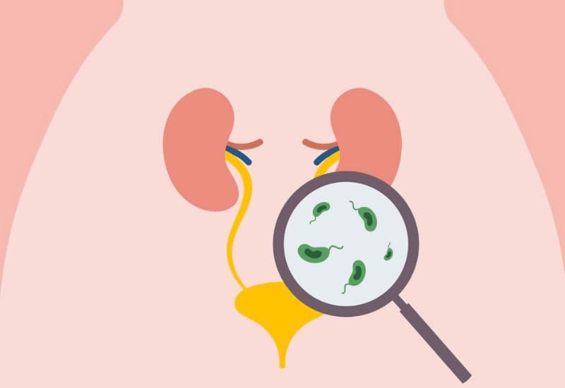 Hậu quả nguy hiểm của thận ứ nước độ 3 nếu không điều trị