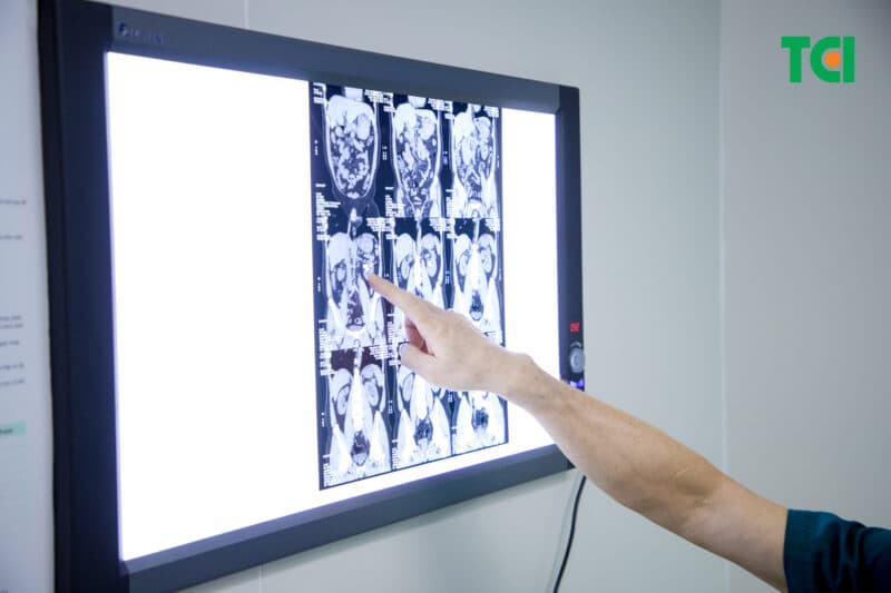 Khi nào đài bể thận giãn trở thành nguy hiểm?