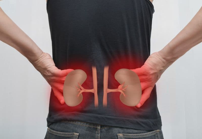 Những biến chứng nguy hiểm của thận ứ nước kèm nhiễm khuẩn