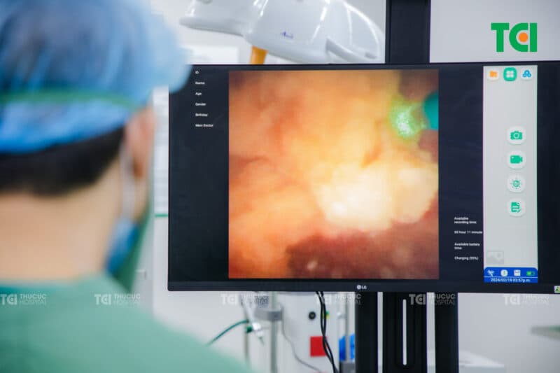 Cách xử lý khi đài bể thận bị giãn