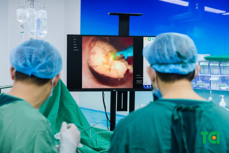 Điều trị sỏi gây giãn đài bể thận 15mm