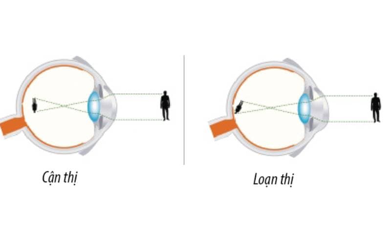 Tròng kính cận loạn đổi màu nào tốt