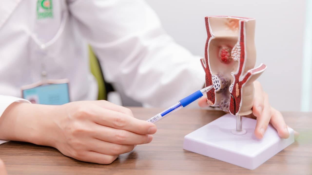 Chảy máu là một trong những triệu chứng đặc trưng của bệnh trĩ