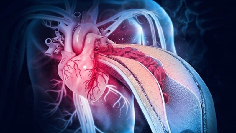 Bệnh mạch vành là gì?