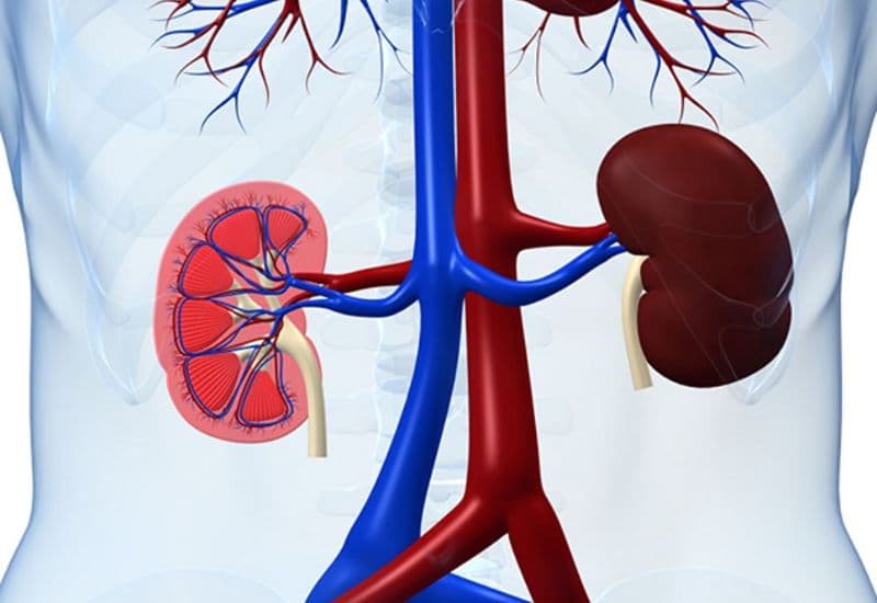 Biến chứng nguy hiểm nếu không điều trị kịp thời thận bị ứ nước