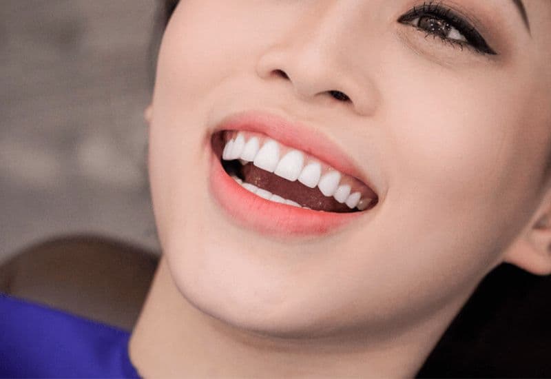 Bọc răng sứ là giải pháp thẩm mỹ răng hiện đại, được nhiều người lựa chọn.