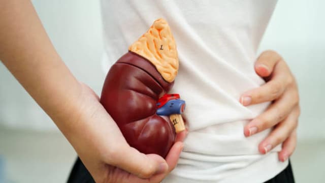 Các mức độ giãn đài bể thận dựa trên kích thước