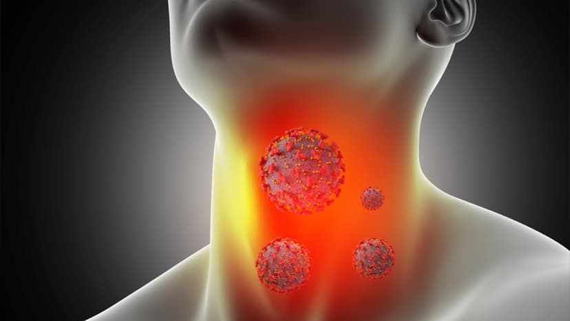 Cách điều trị viêm họng đơn giản, hiệu quả