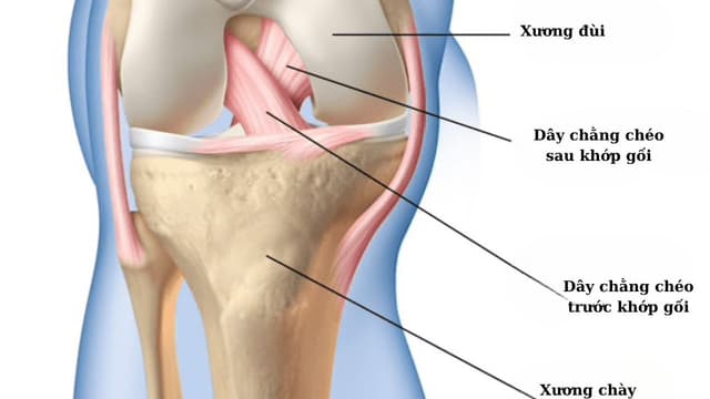Phân biệt dây chằng chéo trước và dây chằng chéo sau khớp gối