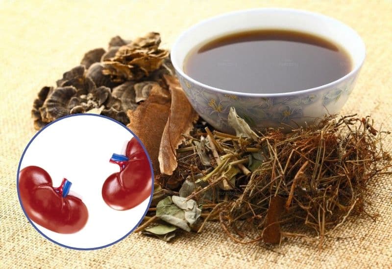 Những hậu quả khi điều trị thận ứ nước bằng thuốc nam sai cách