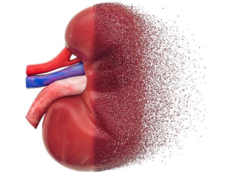 Những tác hại tiềm ẩn khi điều trị thận ứ nước bằng thuốc nam