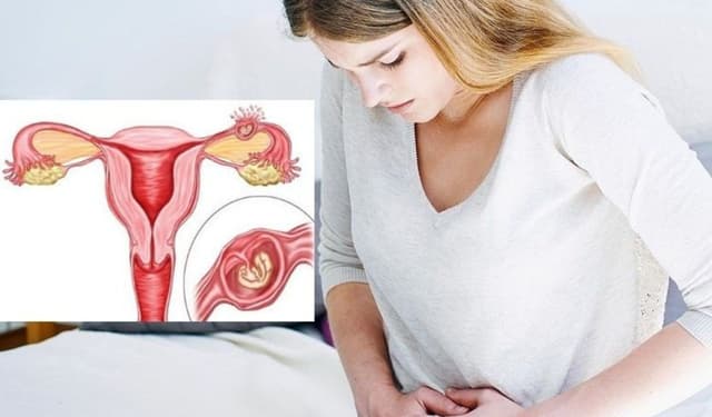 Phòng ngừa mang thai ngoài tử cung: Mẹ cần lưu ý điều gì?